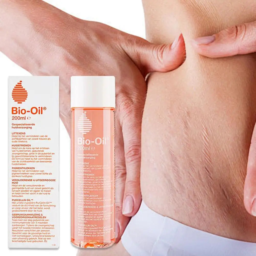 Bio-Oil Body Skin Care Essential for Stretch Marks & Unevenness